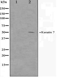 Keratin 7 Antibody