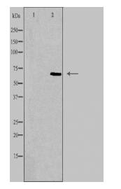 TRIP4 Antibody