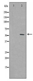 PFKFB1 Antibody