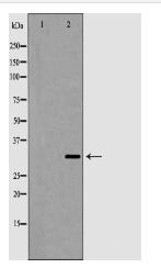 AQP3 Antibody