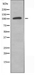 LIPB1 Antibody