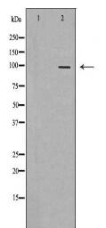 PGR Antibody