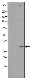 PNMT Antibody