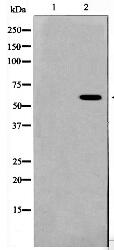 Presenilin 1 Antibody