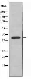 TBX1 Antibody