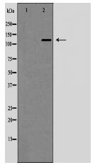 JAK1 Antibody