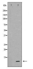 RPS27A Antibody