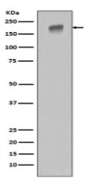 EGFR (ErbB 1) Antibody