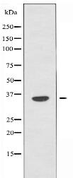 OR6Q1 Antibody