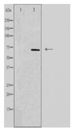 MT-ND5 Antibody