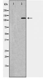 PIK3CA Antibody