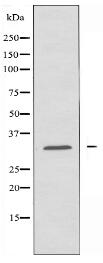 KCNMB2 Antibody