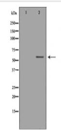 KPNA2 Antibody