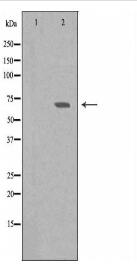 TESK2 Antibody