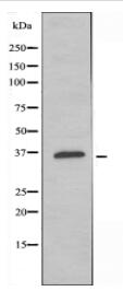 MC4R Antibody