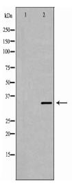 TACSTD1 Antibody