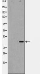 TSG6 Antibody