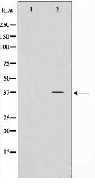 NPM Antibody