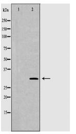 TPSAB1 Antibody