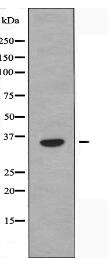 OR52B2 Antibody