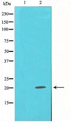 Alpha-synuclein Antibody