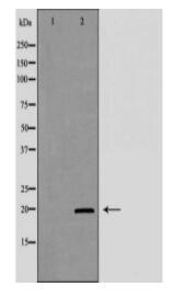 KLRD1 Antibody