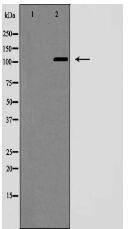 NOTCH2 (Cleaved-Ala1734) Antibody