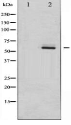 Fyn Antibody