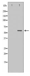 ILK Antibody