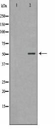 PARK2 Antibody