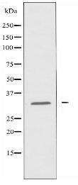 OR4F4 Antibody