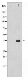 UCP2 Antibody