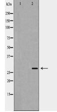 VEGF Antibody