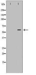 RPS6KB1 Antibody