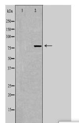 TACC3 Antibody