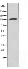 SPINK5 Antibody