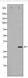 TNFRSF14 Antibody