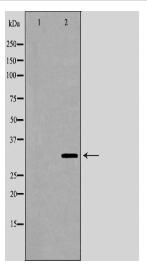 TNFRSF6B Antibody