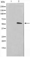 Keratin 15 Antibody