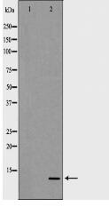 S100 A4 Antibody