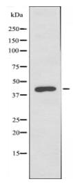 LYAR Antibody