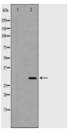 KLK1 Antibody