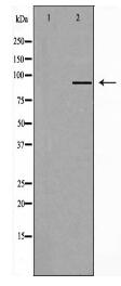 RPTN Antibody