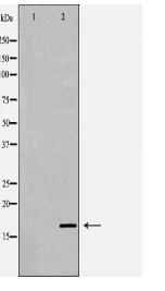 NME1 Antibody