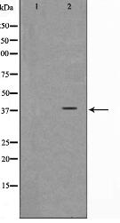 ARMX3 Antibody