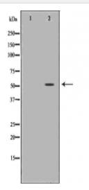 MMP1 Antibody
