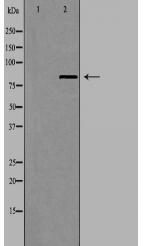 UTP14A Antibody