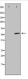 TRIM38 Antibody