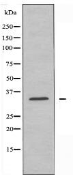 ZDHHC7 Antibody