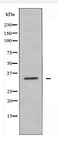 YOD1 Antibody